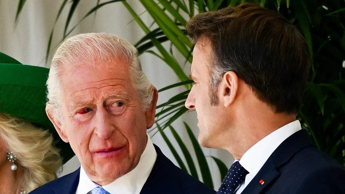King Charles’ Eye Sparked Concern — A Striking Moment During His French State Visit